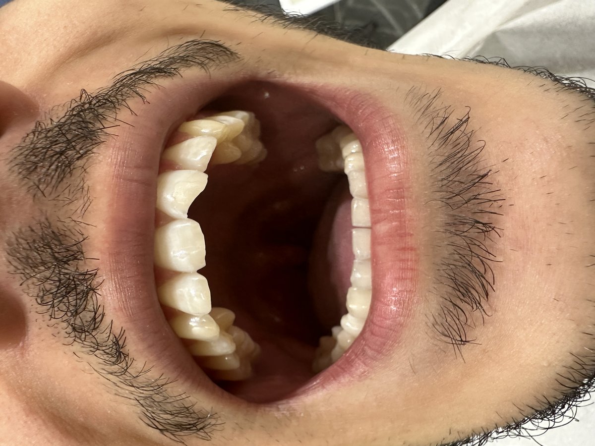 Clinish Dental - Clinish Dental