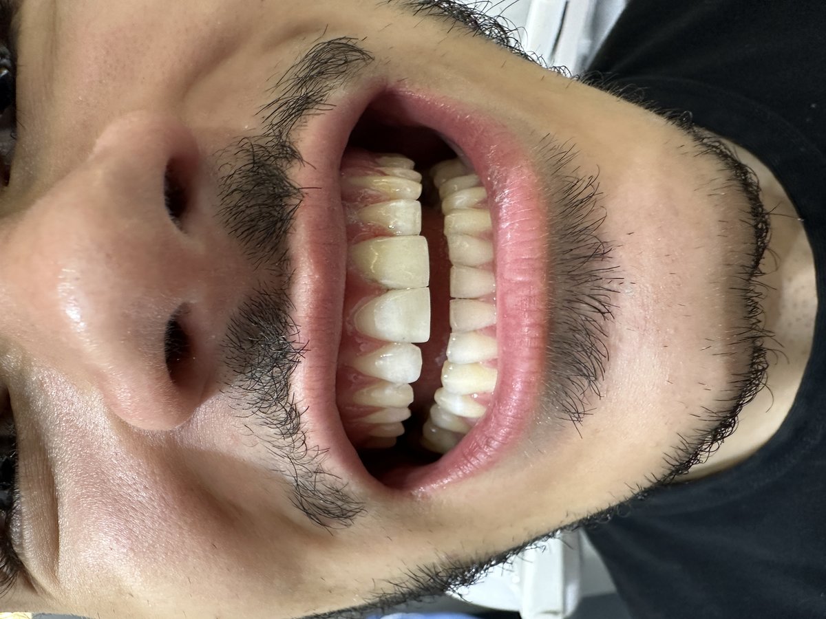 Clinish Dental - Clinish Dental