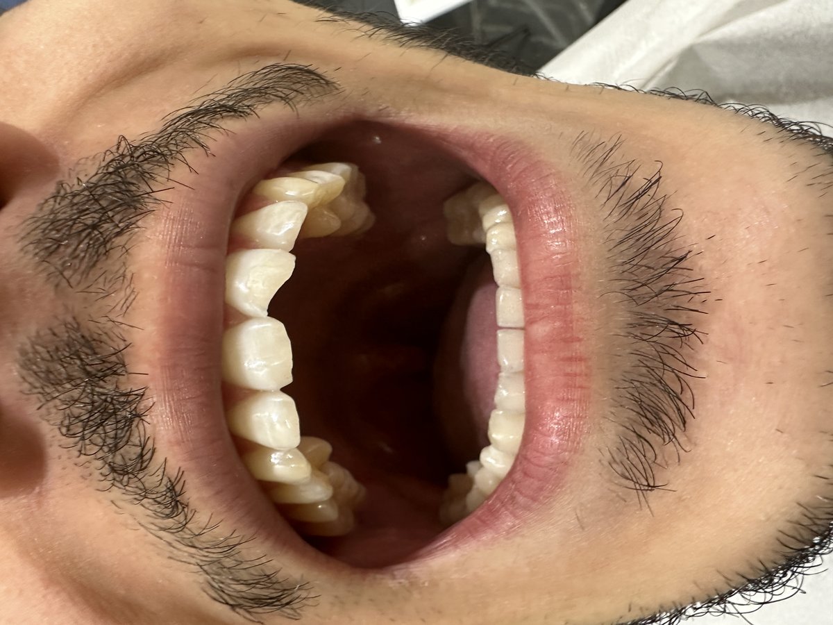 Clinish Dental - Clinish Dental