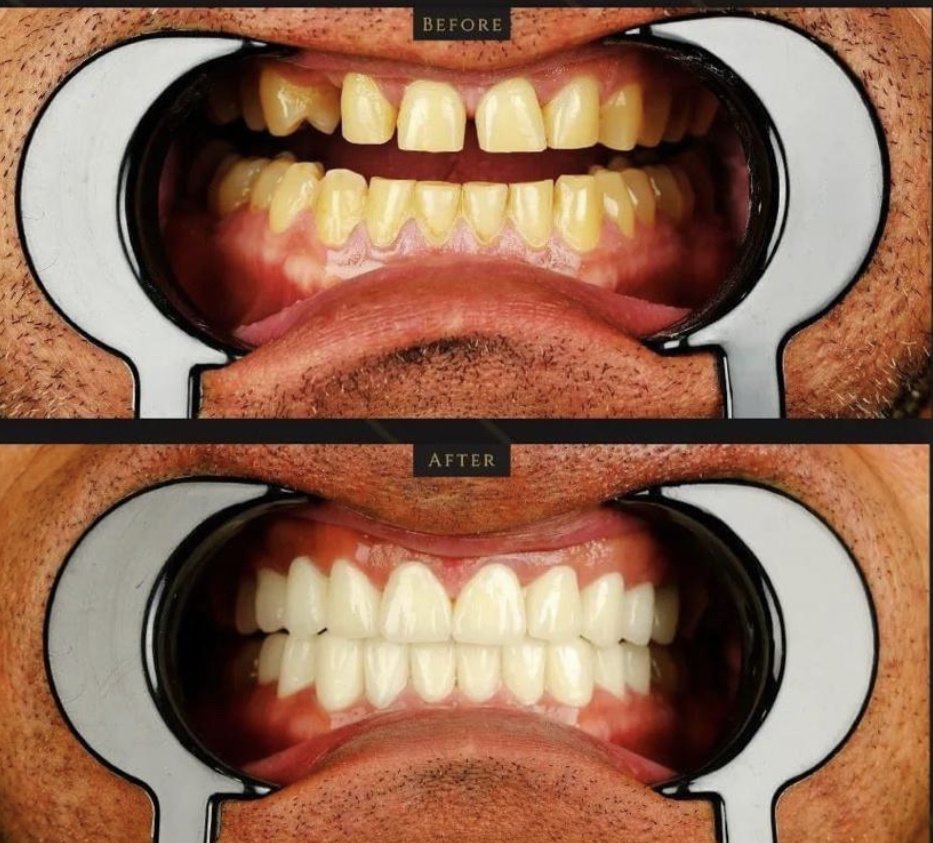 Clinish Dental - Clinish Dental