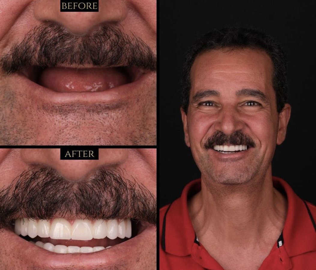 Clinish Dental - Clinish Dental