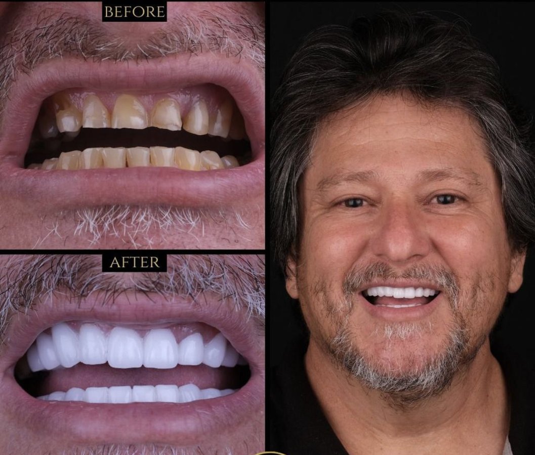 Clinish Dental - Clinish Dental