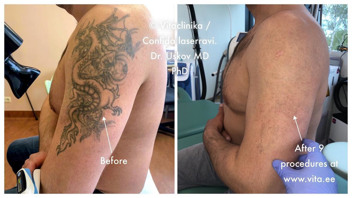 Confido Laserravi Clinic - Confido Laserravi Clinic