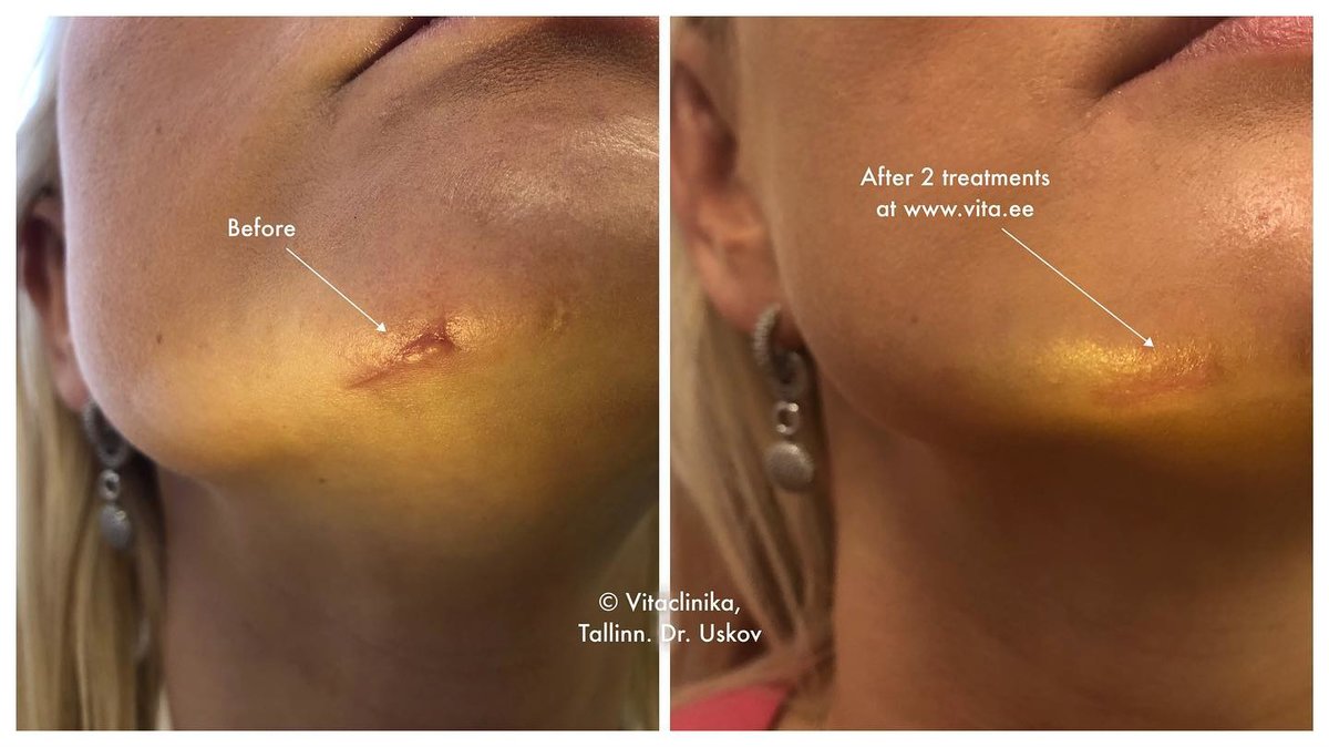 Confido Laserravi Clinic - Confido Laserravi Clinic