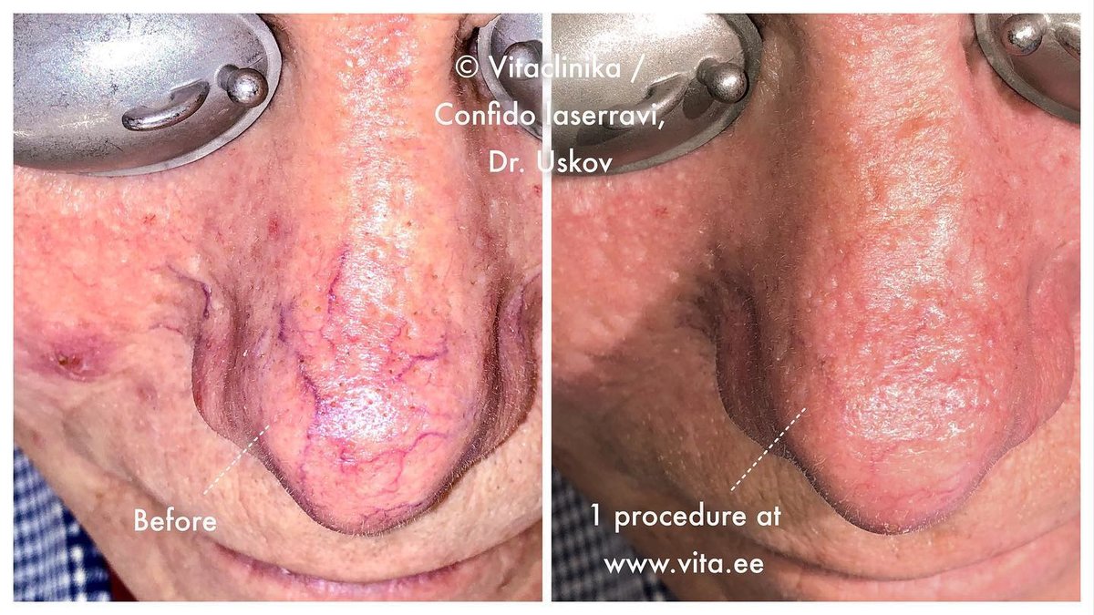 Confido Laserravi Clinic - Confido Laserravi Clinic