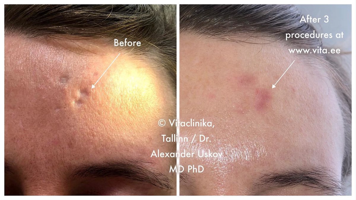 Confido Laserravi Clinic - Confido Laserravi Clinic