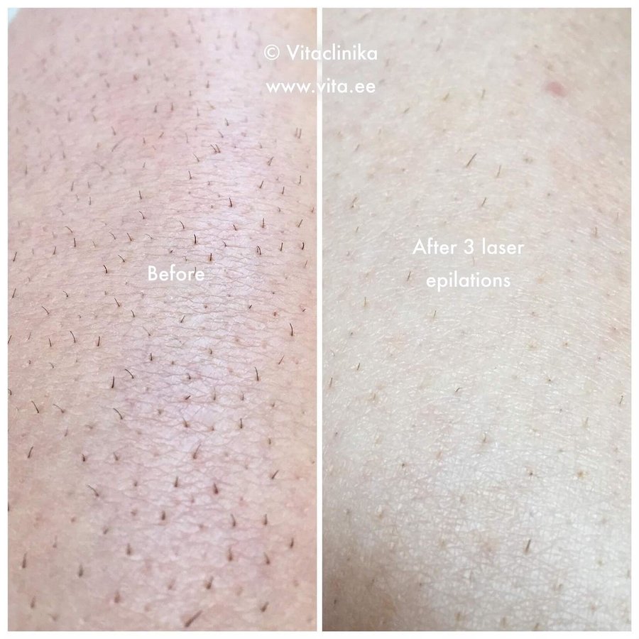 Confido Laserravi Clinic - Confido Laserravi Clinic