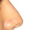 كوردوفا كروجيا بلاستيكا Y Reconstructiva - Cordova Crugia Plastica Y Reconstructiva
