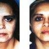 كوردوفا كروجيا بلاستيكا Y Reconstructiva - Cordova Crugia Plastica Y Reconstructiva