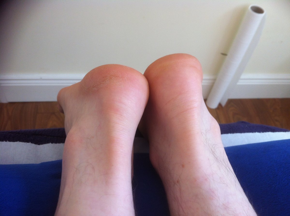 Cork Sports Injury Clinic - Cork Sports Injury Clinic