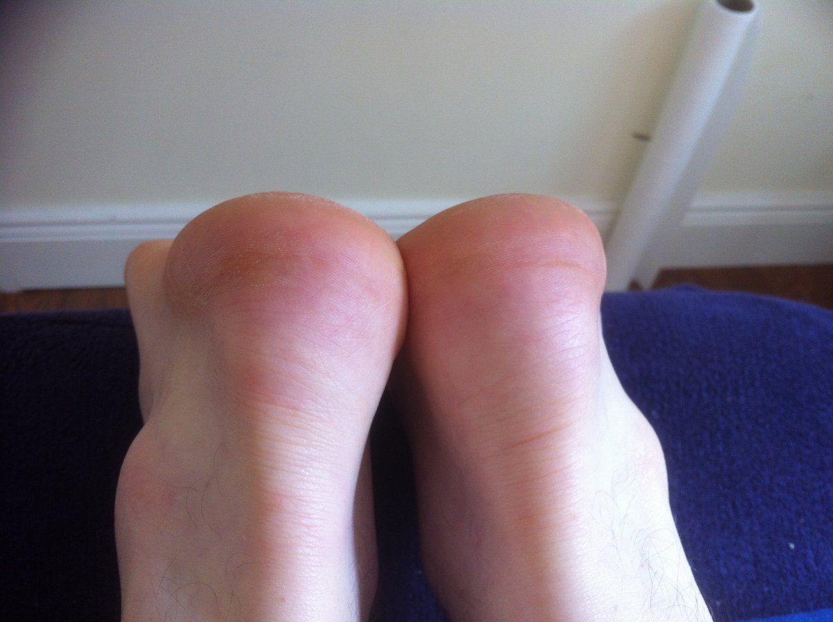 Cork Sports Injury Clinic - Cork Sports Injury Clinic