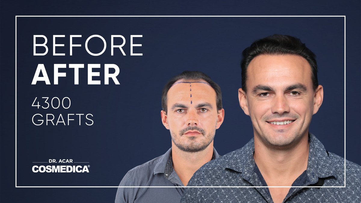 Cosmedica Clinic Hair Transplant - Cosmedica Clinic Hair Transplant