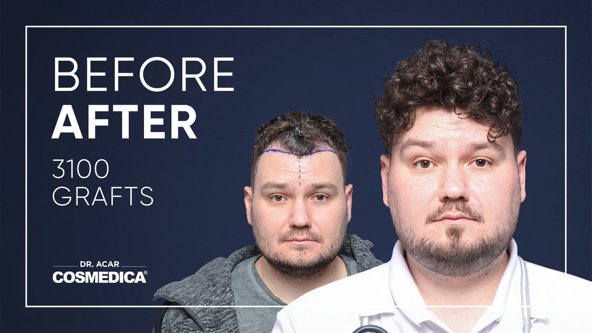 Cosmedica Clinic Hair Transplant - Cosmedica Clinic Hair Transplant