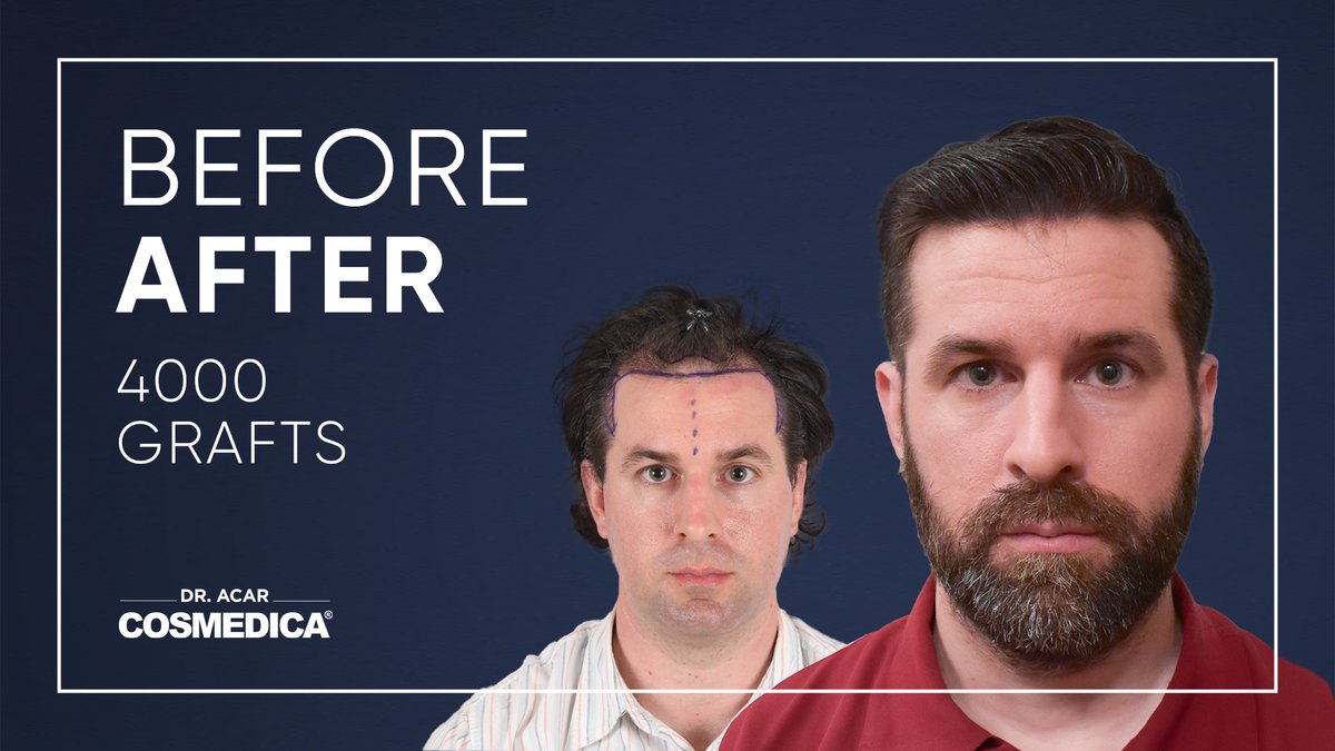 Cosmedica Clinic Hair Transplant - Cosmedica Clinic Hair Transplant