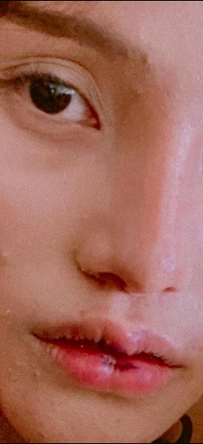 Cosmedics Dermaster Aesthetic Center - Cosmedics Dermaster Aesthetic Center