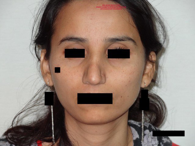 Cosmetic Laser Surgery Center - Cosmetic Laser Surgery Center