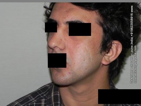 Cosmetic Laser Surgery Center - Cosmetic Laser Surgery Center