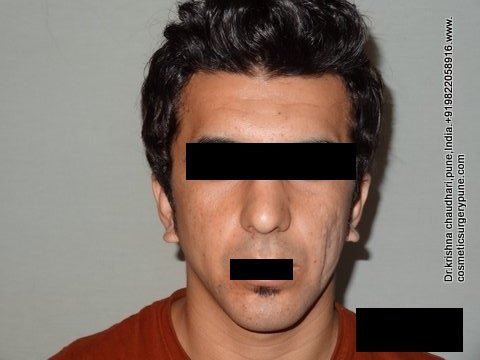 Cosmetic Laser Surgery Center - Cosmetic Laser Surgery Center