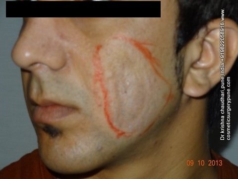 Cosmetic Laser Surgery Center - Cosmetic Laser Surgery Center