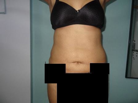 Cosmetic Laser Surgery Center - Cosmetic Laser Surgery Center