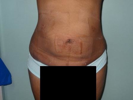 Cosmetic Laser Surgery Center - Cosmetic Laser Surgery Center