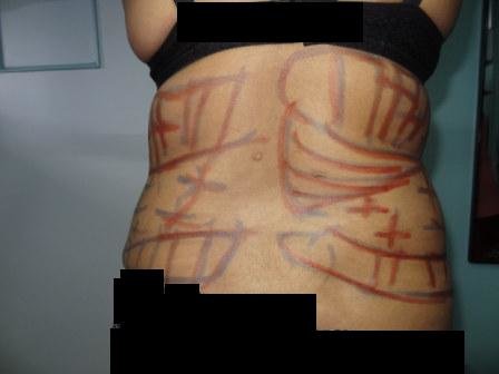 Cosmetic Laser Surgery Center - Cosmetic Laser Surgery Center