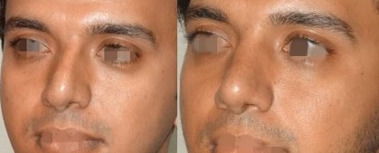 Cosmetic Laser Surgery Center - Cosmetic Laser Surgery Center