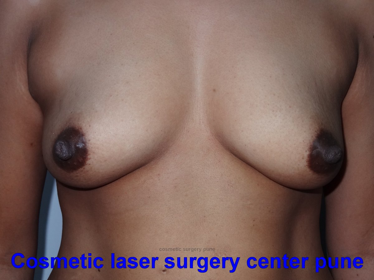Cosmetic Laser Surgery Center - Cosmetic Laser Surgery Center