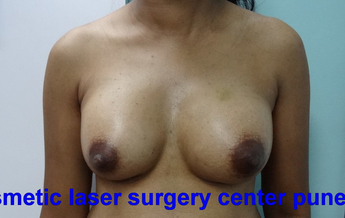 Cosmetic Laser Surgery Center - Cosmetic Laser Surgery Center