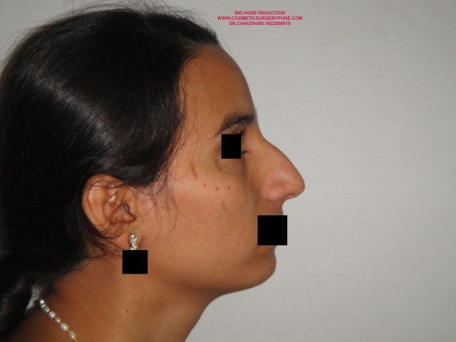 Cosmetic Laser Surgery Center - Cosmetic Laser Surgery Center