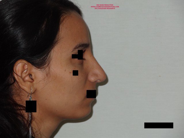 Cosmetic Laser Surgery Center - Cosmetic Laser Surgery Center