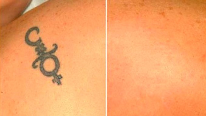 Cosmetic Treatments by L.A - Cosmetic Treatments by L.A