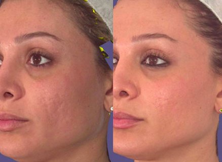 Cosmetic Treatments by L.A - Cosmetic Treatments by L.A