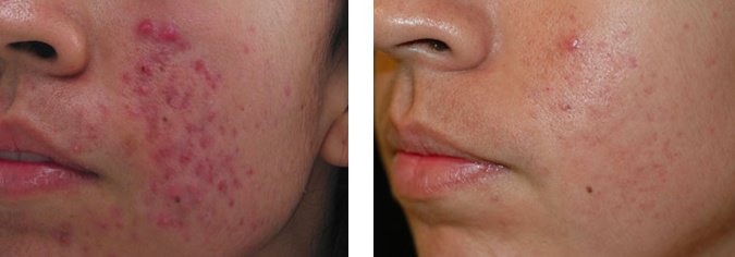 Cosmetic Treatments by L.A - Cosmetic Treatments by L.A