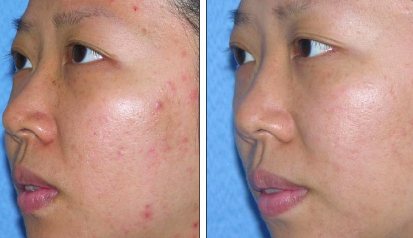 Cosmetic Treatments by L.A - Cosmetic Treatments by L.A