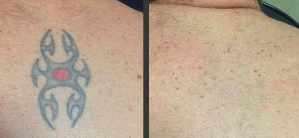 Cosmetic Treatments by L.A - Cosmetic Treatments by L.A