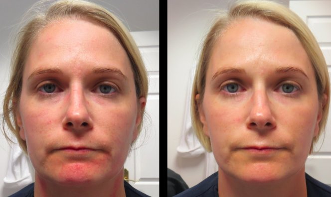 Cosmetic Treatments by L.A - Cosmetic Treatments by L.A
