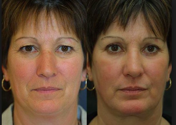 Cosmetic Treatments by L.A - Cosmetic Treatments by L.A