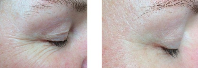Cosmetic Treatments by L.A - Cosmetic Treatments by L.A