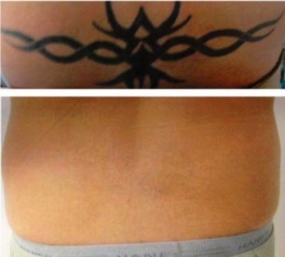 Cosmetic Treatments by L.A - Cosmetic Treatments by L.A