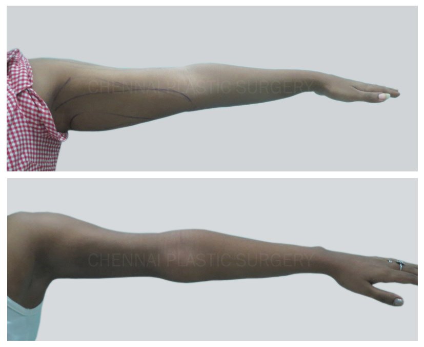 Cosmoglitz Cosmetic Centre - Cosmoglitz Cosmetic Centre