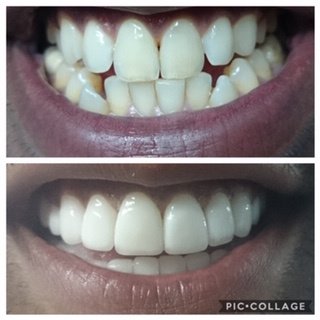 Costa Rica Dental Clinic Lab - Costa Rica Dental Clinic Lab