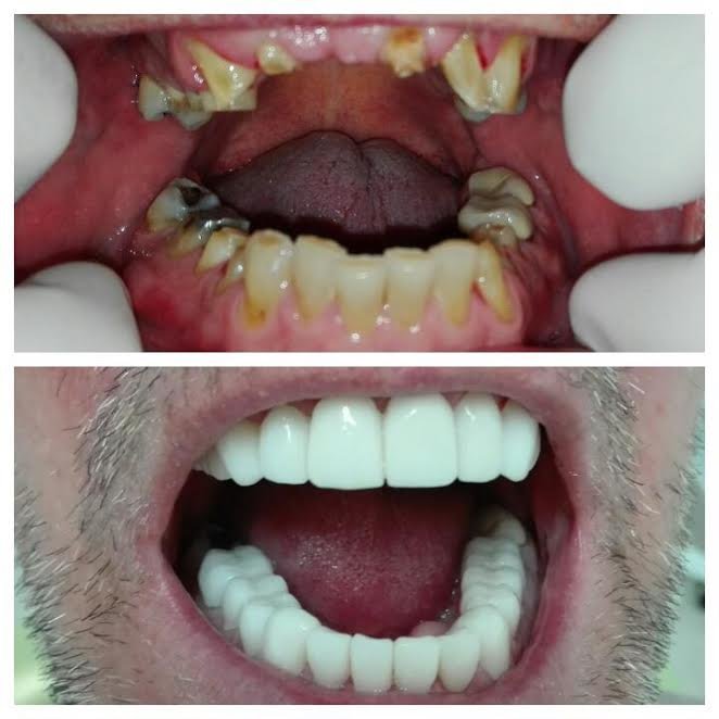 Costa Rica Dental Clinic Lab - Costa Rica Dental Clinic Lab