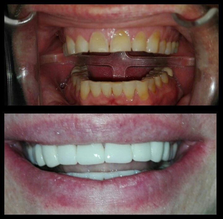 Costa Rica Dental Clinic Lab - Costa Rica Dental Clinic Lab