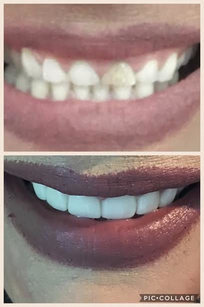 Costa Rica Dental Clinic Lab - Costa Rica Dental Clinic Lab