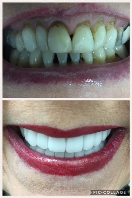 Costa Rica Dental Clinic Lab - Costa Rica Dental Clinic Lab