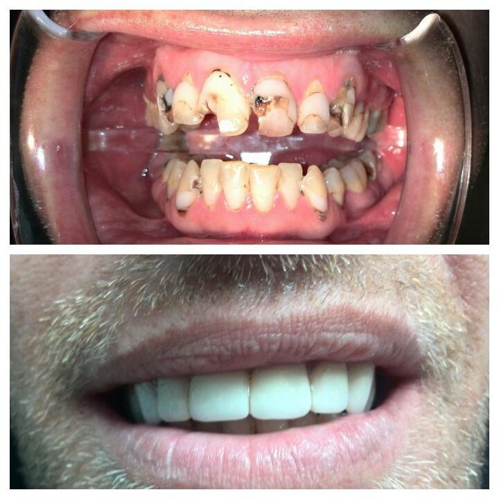 Costa Rica Dental Clinic Lab - Costa Rica Dental Clinic Lab