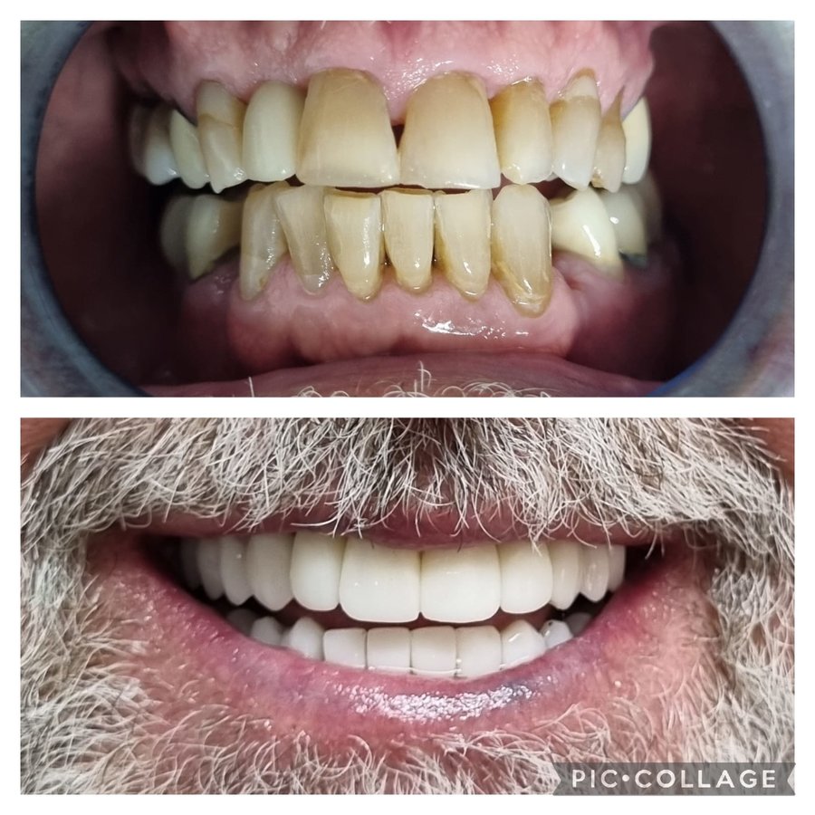 Costa Rica Dental Clinic Lab - Costa Rica Dental Clinic Lab