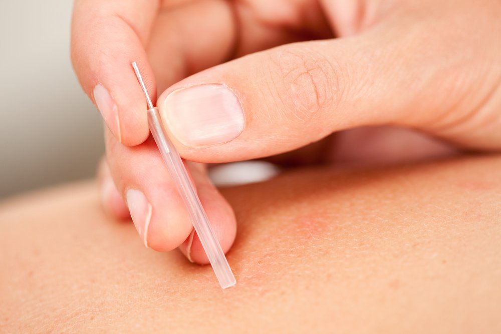 Cove Acupuncture Clinic - Cove Acupuncture Clinic