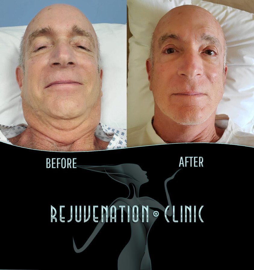 Cozumel Rejuvenation Clinic - Cozumel Rejuvenation Clinic